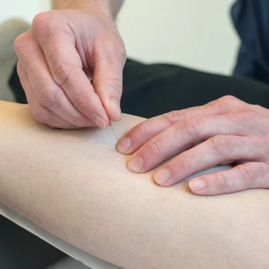Dry Needling Fyzie 