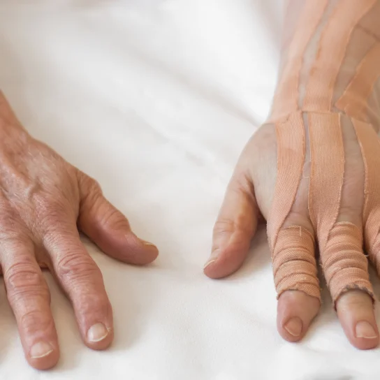 Oedeemtherapie Fyzie