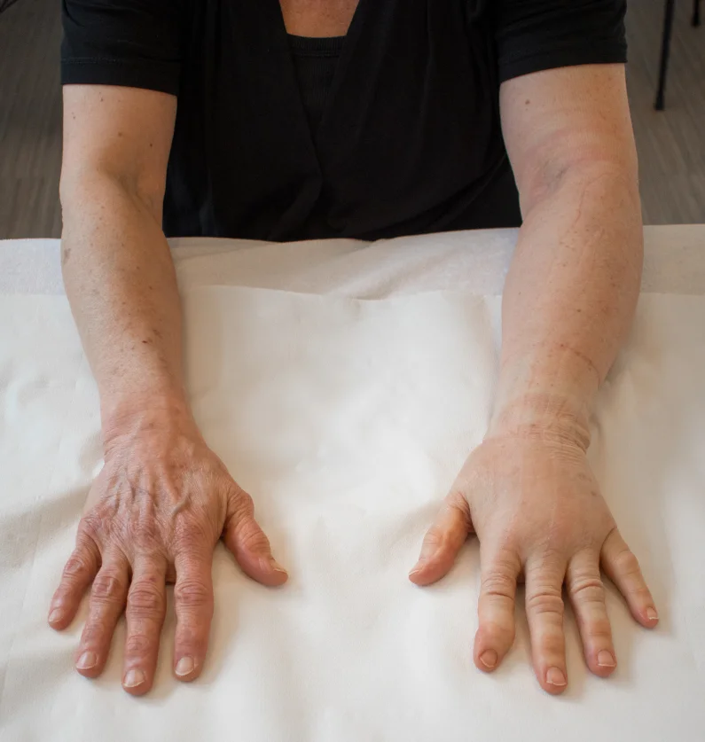 Sporten na chemo fysiotherapie Fyzie 